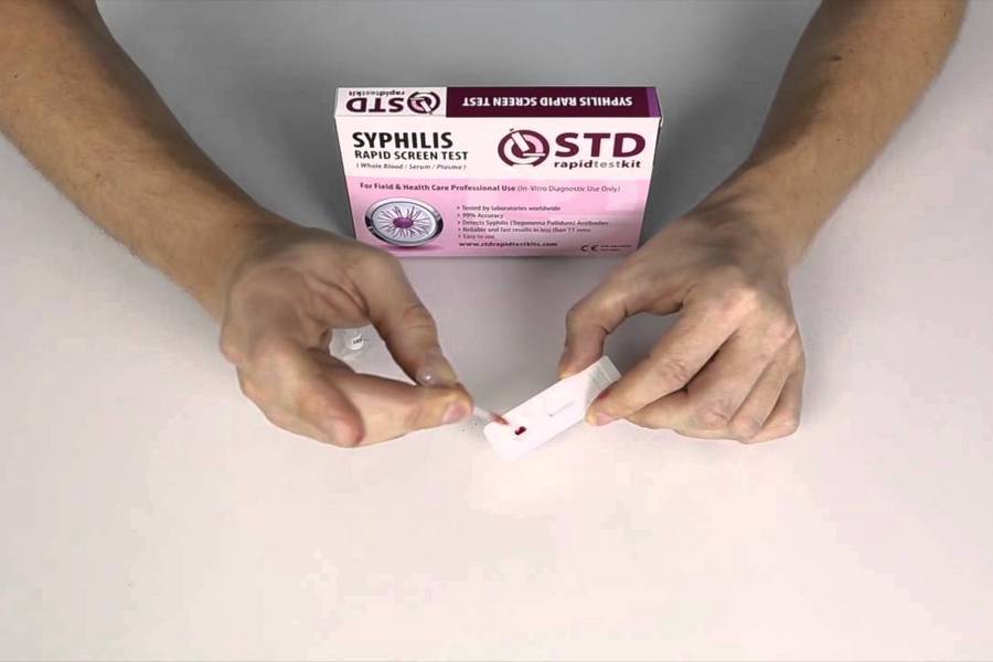 HIV Test in Dubai